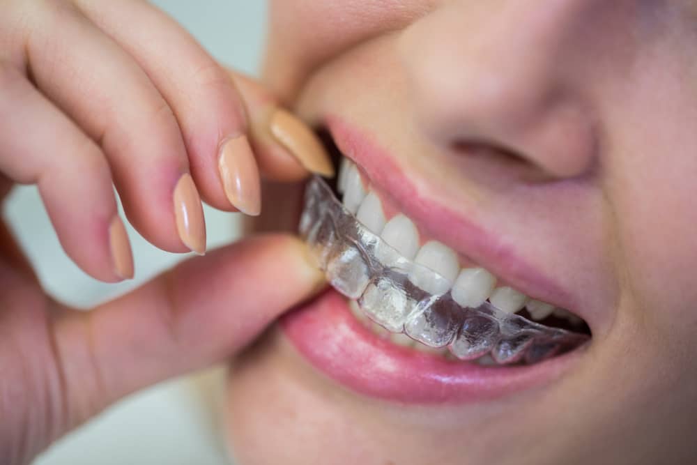 Eating, Drinking & Smiling: How Invisalign Fits Into Your Daily Life