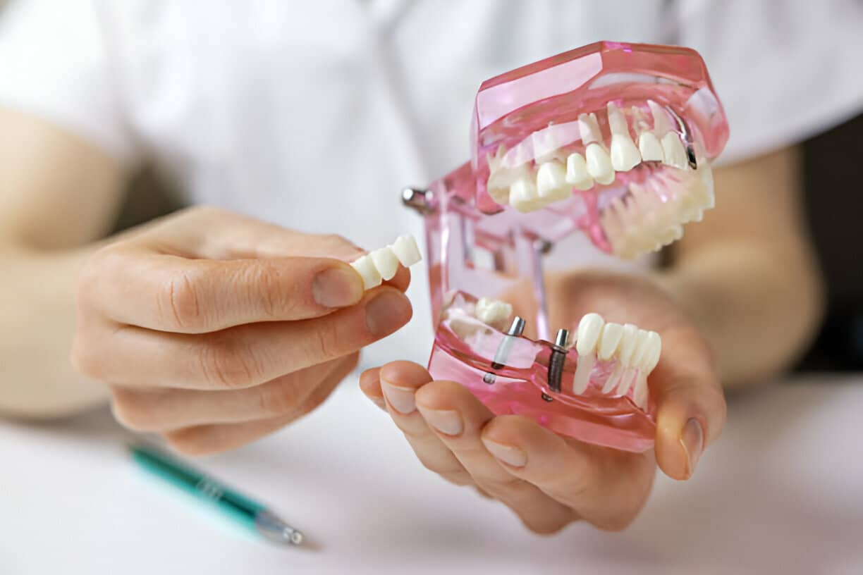 How Painful Is Getting One Dental Implant?