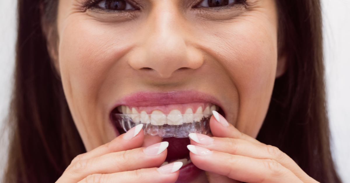 eating with invisalign foods to avoid and daily care tips