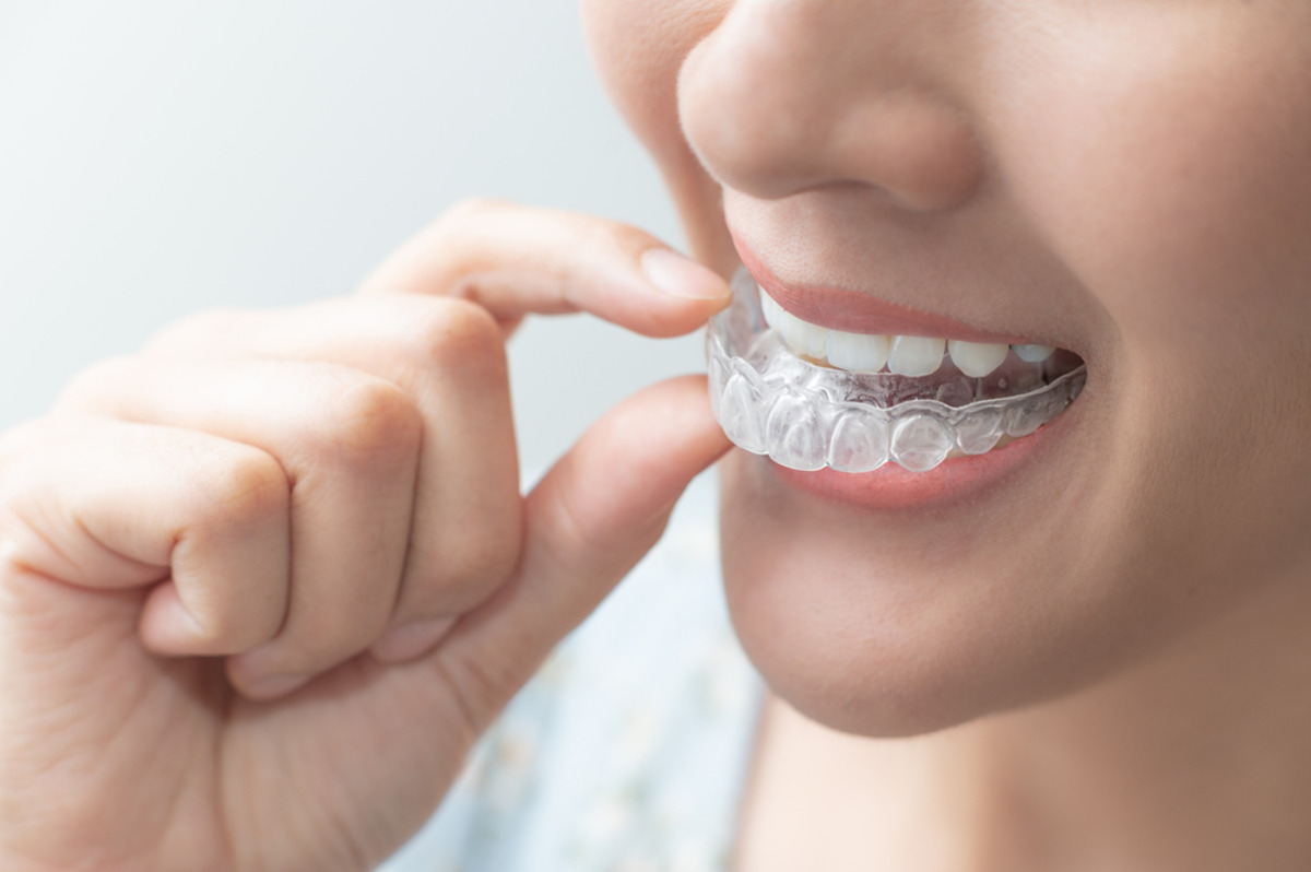how to wear Invisalign comfortably